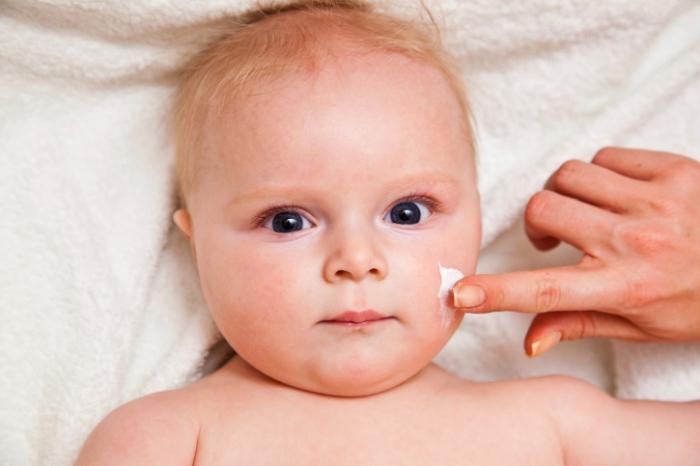 Jak je léčba atopické dermatitidy u dítěte?