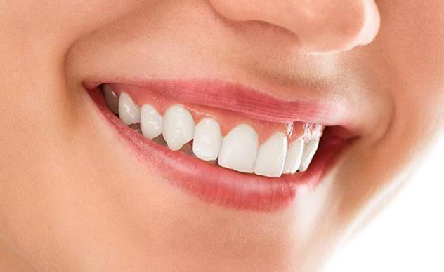 Z parodontózy zubní pasty: který z nich si vybrat? Pasty z paradentní choroby: 